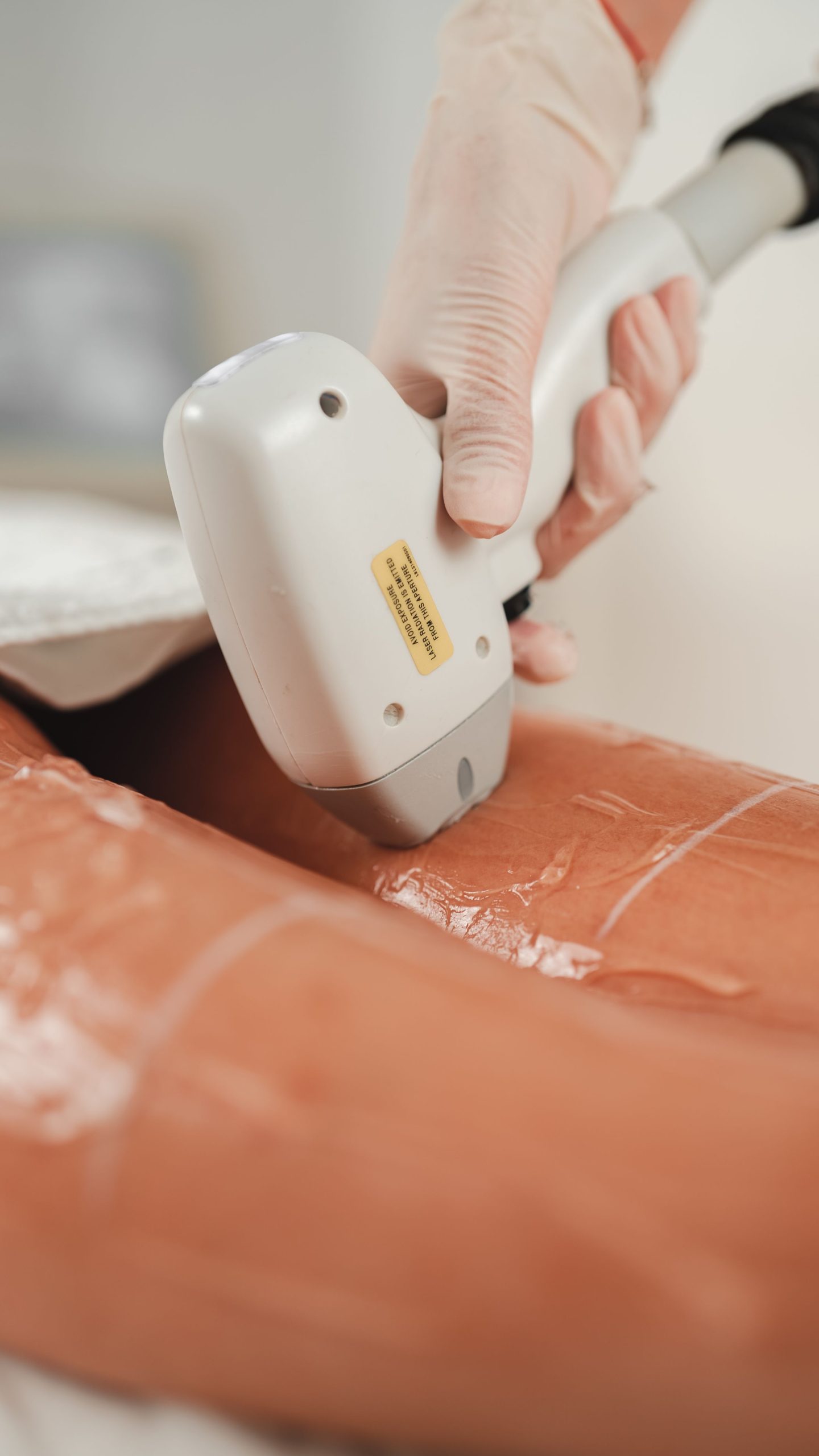 Professionelle Laser-Haarentfernung bei Laser Aesthetic Heidelberg