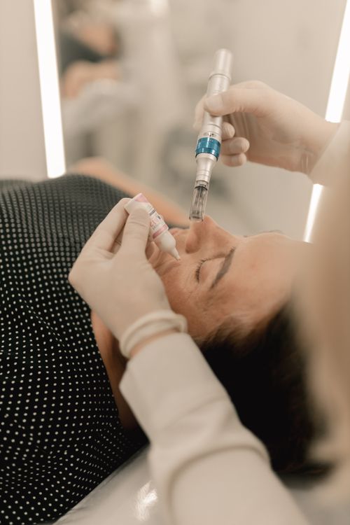 Professionelles kosmetisches Microneedling während einer Gesichtsbehandlung